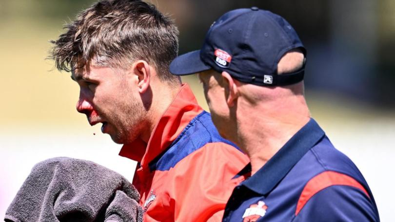 Henry Hunt has suffered a suspected broken nose after being struck by a ball while fielding. (Joel Carrett/AAP PHOTOS)