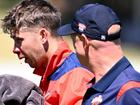 Henry Hunt has suffered a suspected broken nose after being struck by a ball while fielding. (Joel Carrett/AAP PHOTOS)