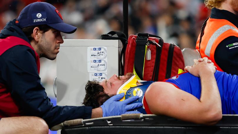 Angus Brayshaw has retired for medical reasons after his horror concussion in last year’s finals.