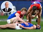 Leigh Matthews says the interchange bench should be removed after Angus Brayshaw was forced to retire.