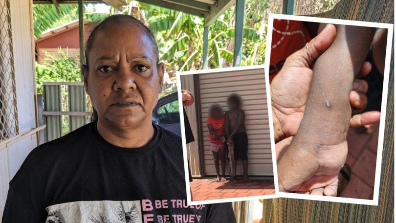 A relative of two children who were cable-tied in Broome yesterday has revealed their wrists were allegedly bound so tight the youngsters were bleeding when they were found.