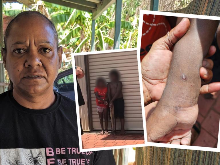 A relative of two children who were cable-tied in Broome yesterday has revealed their wrists were allegedly bound so tight the youngsters were bleeding when they were found.