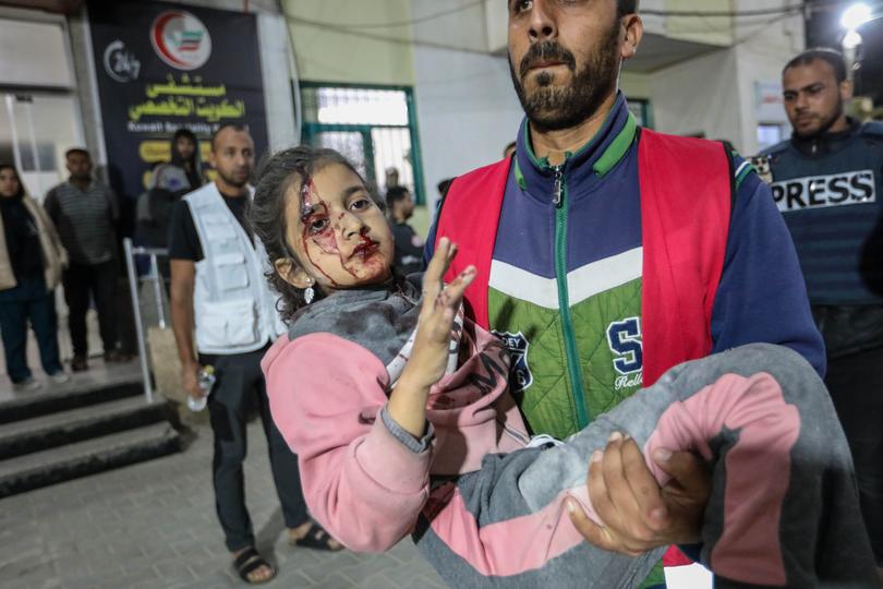 RAFAH, GAZA - MARCH 14: (Editor's note: Image contains graphic content) A young Palestinian injured in Israeli air strikes arrives for treatment at Kuwait Hospital, on March 14, 2024 in Rafah, Gaza. As of Thursday February 29th, more than 30,000 people had been killed in Gaza since the start of the war on Oct. 7, according to the territory's health ministry. Also this week, more details have emerged of a potential new ceasefire deal that could start before Ramadan, pending further negotiations by Israel, Hamas and foreign mediators. (Photo by Ahmad Hasaballah/Getty Images)