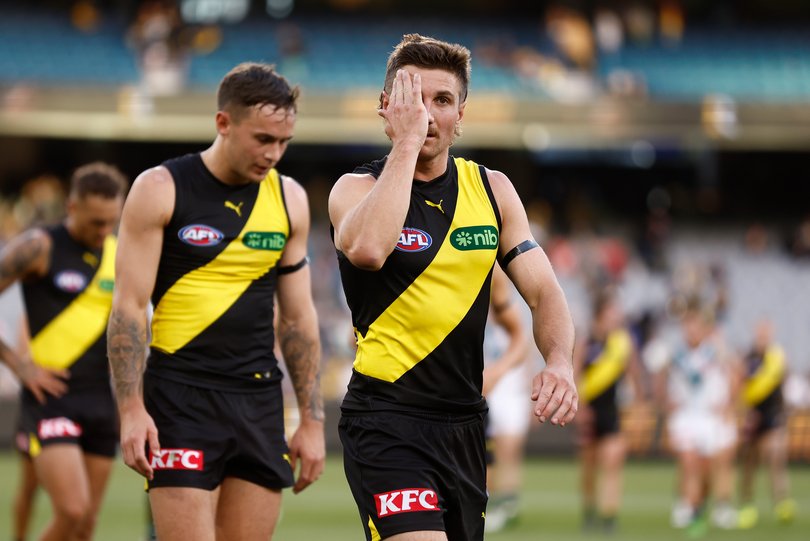 Liam Baker will miss this weekend’s clash for the already undermanned Tigers.