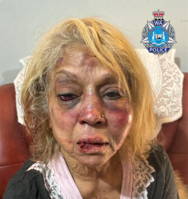 Police released this image of the woman’s horrific injuries.