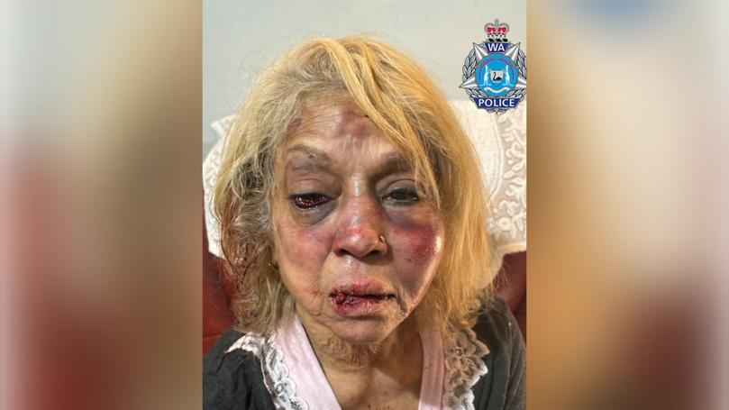 One of the trio accused of bashing a pensioner in WA is an immigration detainee released after a landmark High Court ruling. Pictured is victim Ninette Simons.