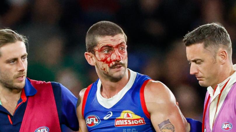 MELBOURNE, AUSTRALIA - MAY 05: Tom Liberatore of the Bulldogs leaves the field under the blood rule during the 2024 AFL Round 08 match between the Western Bulldogs and the Hawthorn Hawks at Marvel Stadium on May 05, 2024 in Melbourne, Australia. (Photo by Dylan Burns/AFL Photos via Getty Images)