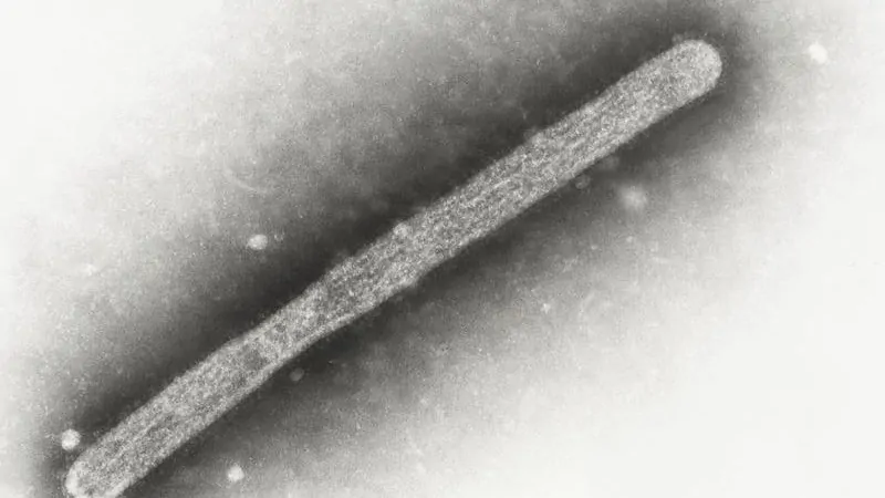 Bird Flu Victoria: First Australian human case of strain H5N1 detected ...