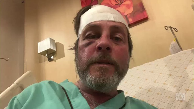 Keith Davis says his wife Kerry Jordan is suffering severe spinal trauma, with no sensation from the waist down. 