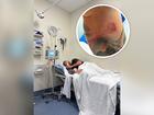 A Perth woman has issued a grim health warning after a bizarre tattoo mishap left her partner unable to walk or talk and turned his skin yellow.