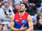 Melbourne star Christian Petracca has undergone surgery after multiple injuries.