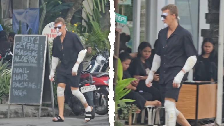 Balinese tourists had another reason to look twice crossing the street last week when British holidaymaker James Marsland strolled through Canggu bandaged head-to-toe like an Egyptian Mummy.