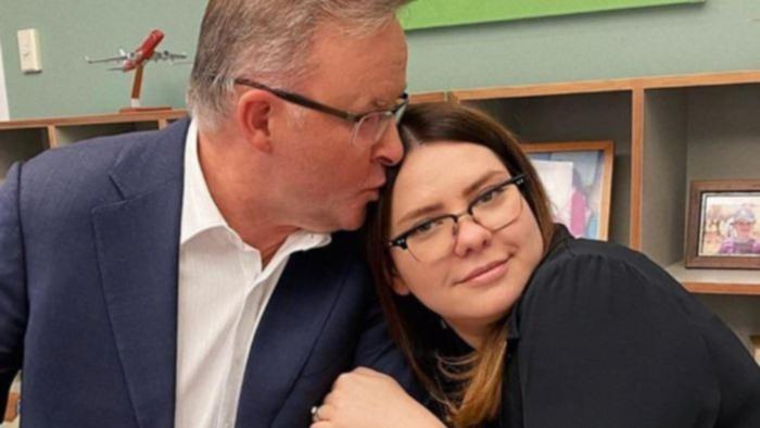 Anthony Albanese and Sabina Husic, who has recently been hired as a lobbyist for TikTok.