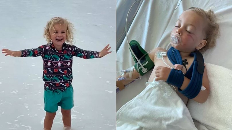 Parker Galloway before and after the accident.