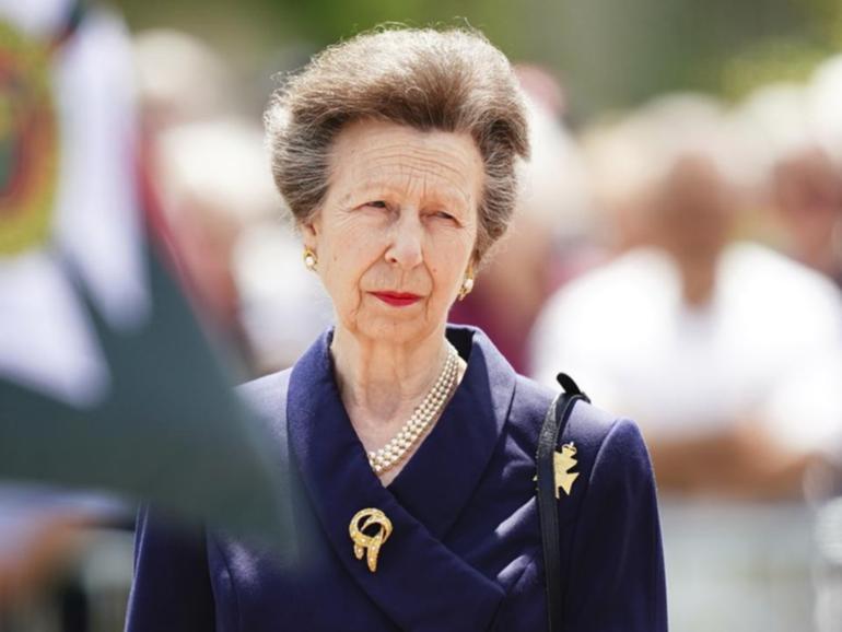 Princess Anne’s injury is significant and Dr Martin Scurr says she must not rush back.  (AP PHOTO)