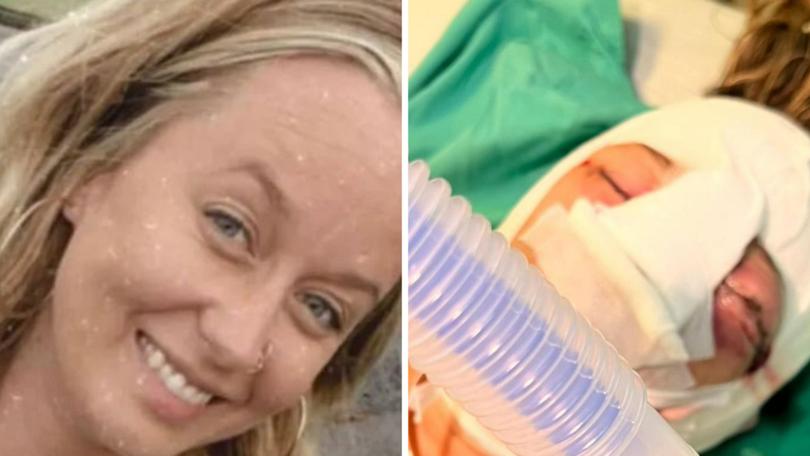 The family of an Australian woman who received horrific injuries in an incident in Bali is desperately trying to bring her home for medical care.