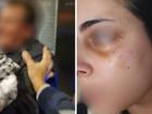 Police have charged a 64-year-old man with assault after he alleged attacked a group wearing Palestinian keffiyehs in an Adelaide hotel. 
