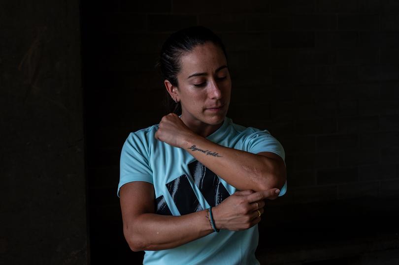 Mariana Pajon, a Colombian BMX rider, shows a scar from among her many surgeries.