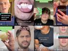 If you search “facial fitness chewing gum” on TikTok, you’ll see dozens of videos of young men — from late teens to early 20s — chewing gum that touts one eyebrow-raising benefit: developing a chiselled jawline.