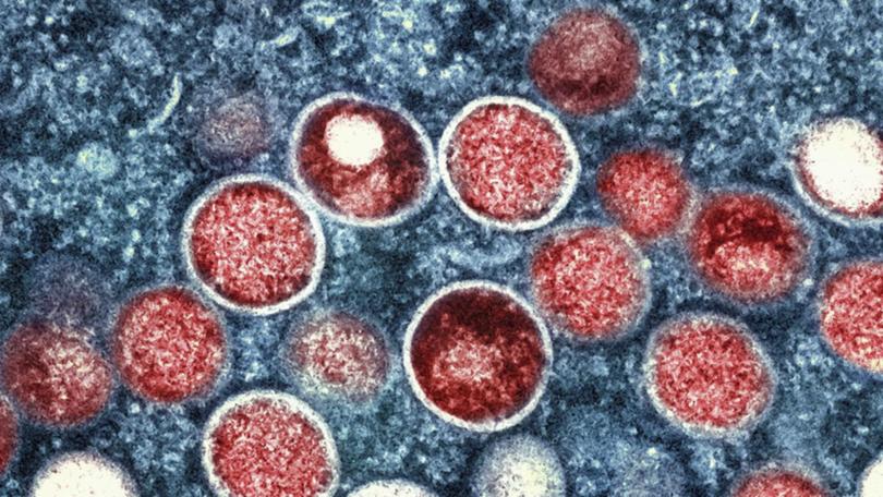 Swedish health officials have identified the country's first case of a more infectious form of mpox. 