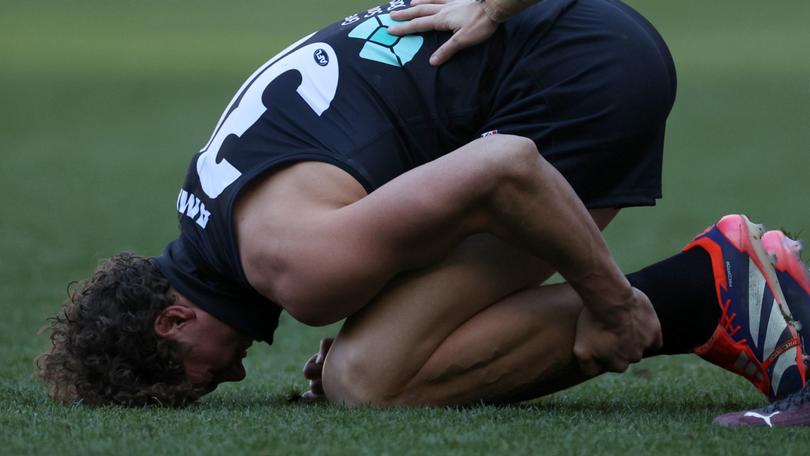 Charlie Curnow was injured against Hawthorn Hawks earlier this month.