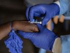 "We can and must tackle mpox together," said Hans Kluge, WHO regional director for Europe. (AP PHOTO)