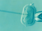 A major IVF group has agreed to settle a class action after healthy embryos were destroyed in error. 