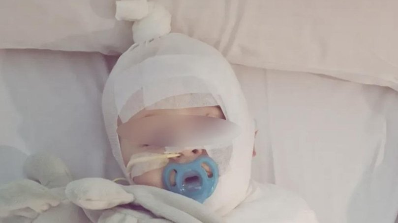 Baby Luka was severely burned and had to endure multiple surgeries over a gruelling week in hospital.