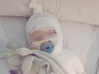 Baby Luka was severely burned and had to endure multiple surgeries over a gruelling week in hospital.