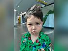 A four-year-old boy has been left with permanent nerve damage to his face after he was mauled by a dog while playing at his friend’s house last month.