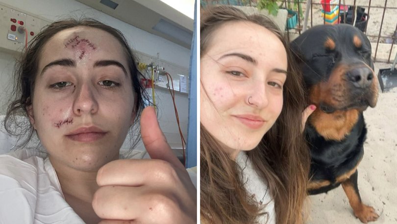 A 19-year-old Perth woman has shared a warning after she was mauled by a dog she has known since it was a puppy.