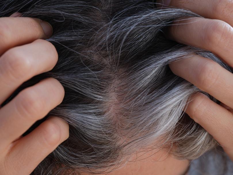 Grey hair also grows faster than pigmented hair.