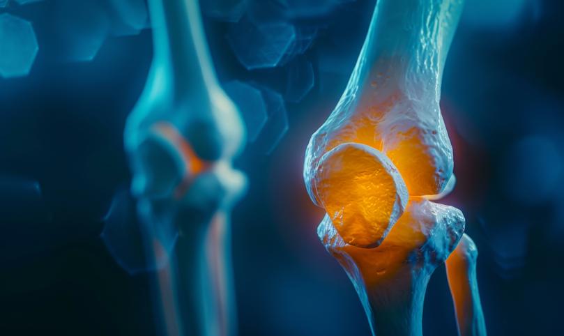 The NHS already performs an estimated 100,000 knee replacement operations a year.