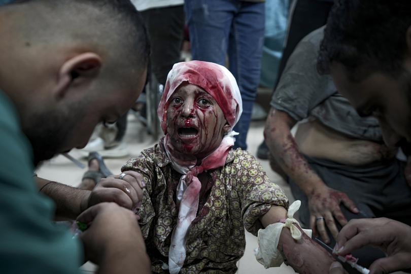 A Palestinian child injured during the Israeli bombardment of the Gaza Strip is treated in a hospital in Deir al-Balah, Thursday, October 10, 2024. 