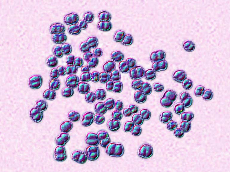 Meningococcus or meningococcal disease or Neisseria meningitidis, is a bacteria involved in meningitis. 