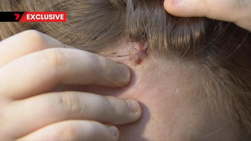 A young girl with an intellectual disability has allegedly been attacked with a hammer.