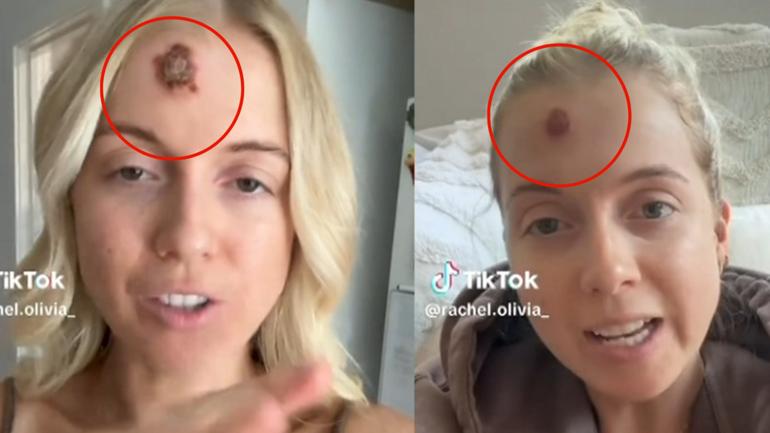 Young mother shares stark warning about TikTok sweeping teenage girls 