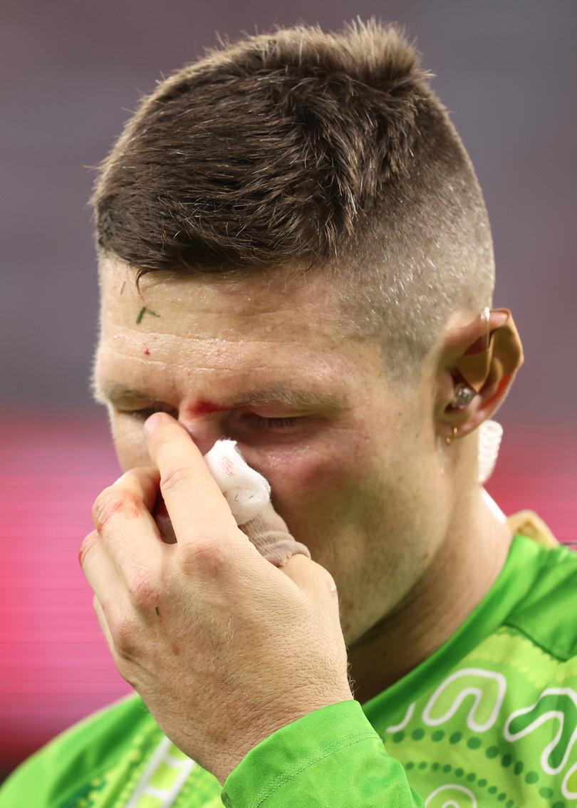 Cam Bancroft broke his nose playing for Sydney Thunder on Friday night. 