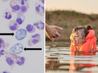 A deadly brain-eating amoeba lurks in freshwater swimming holes – here’s what you need to know.