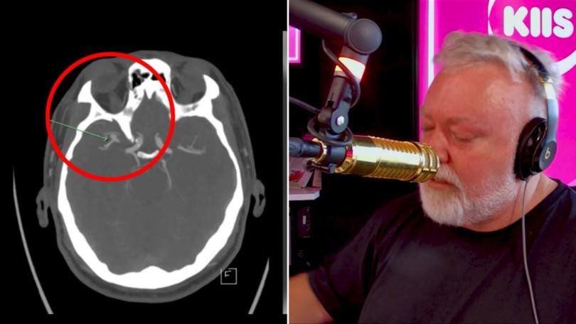 KIIS FM star Kyle Sandilands has hit back at a shocking rumour after revealing he needs surgery for a brain aneurysm.