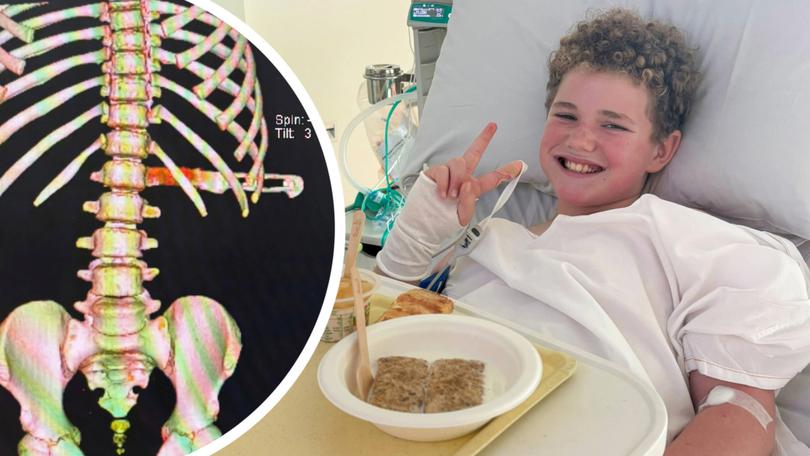 Landen Sturman was making a cheese toastie at home when he tripped backwards into an open dishwasher and fell on to a steak knife.