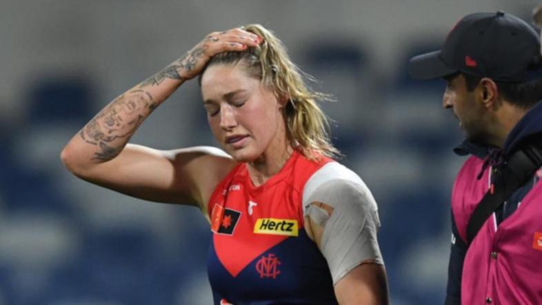 Tayla Harris is ready to perform for Melbourne despite a shoulder injury and a failed trade attempt. (Julian Smith/AAP PHOTOS)