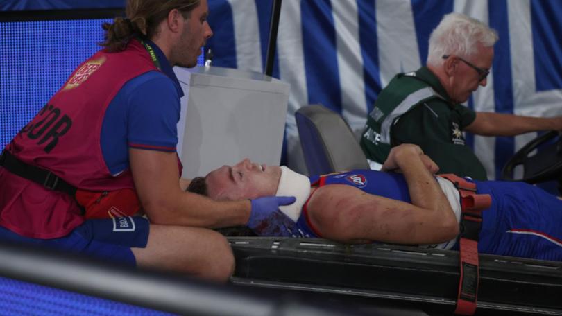 Luke Cleary has been cleared of any structural damage.