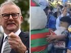 Anthony Albanese has defended “Reggie the Rabbit” over claims he pushed nine-year-old Sharks fan.