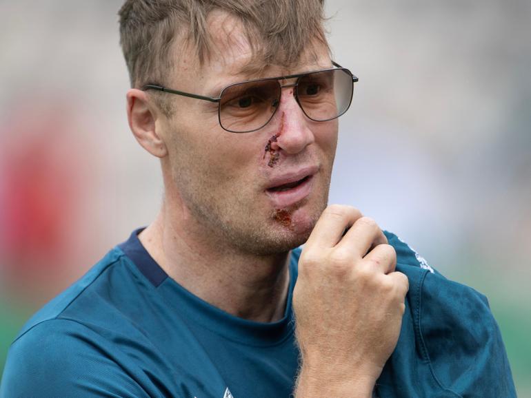 Former England cricketer Andrew Flintoff has opened up on his near-fatal car crash. 