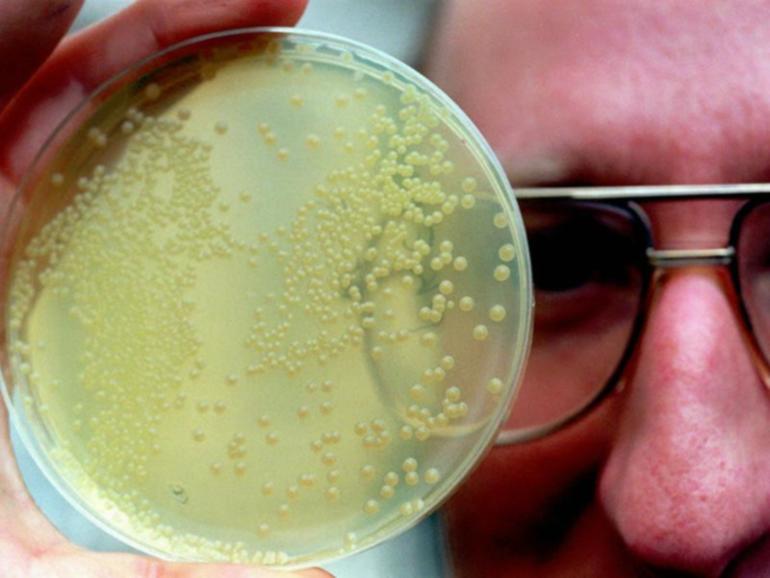 Experts say research shows bacteria might be contributing to a rise in bowel cancer in young people. (AP PHOTO)