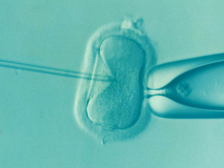 A top IVF layer has warned a recent mix up in Australia may not be the country’s first. 