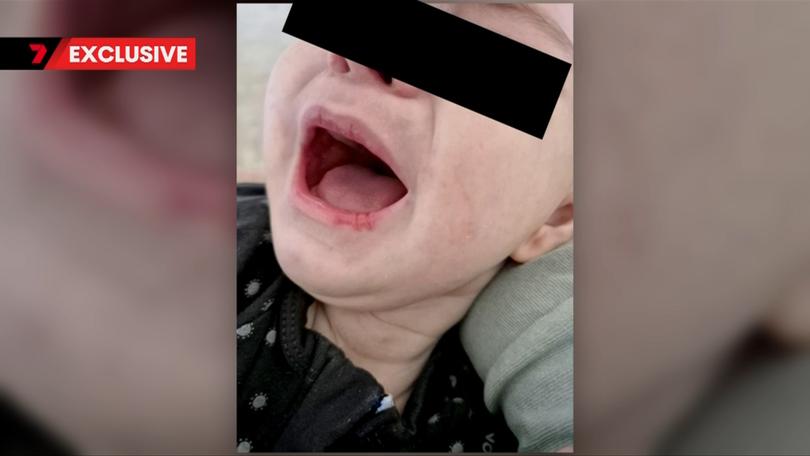 Aussie parents say their little boy became sick after using a formula made by Coco2 Australia.