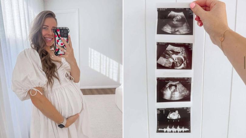 Caitlin Bailey, who already has two boys and a girl, paid $45,000 to make sure her next IVF pregnancy would be another girl.