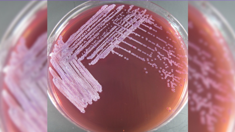 Another man has died of melioidosis in Townsville.